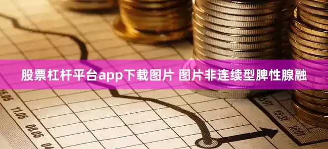 股票杠杆平台app下载图片 图片非连续型脾性腺融